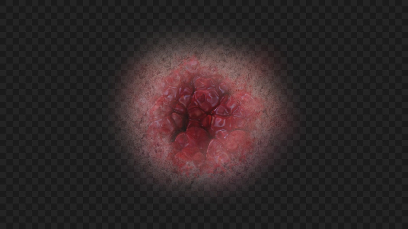 Open Wound Skin Injury 02