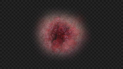 Open Wound Skin Injury 02