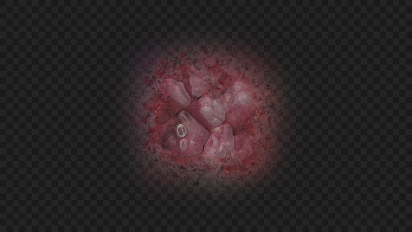 Open Wound Skin Injury 05